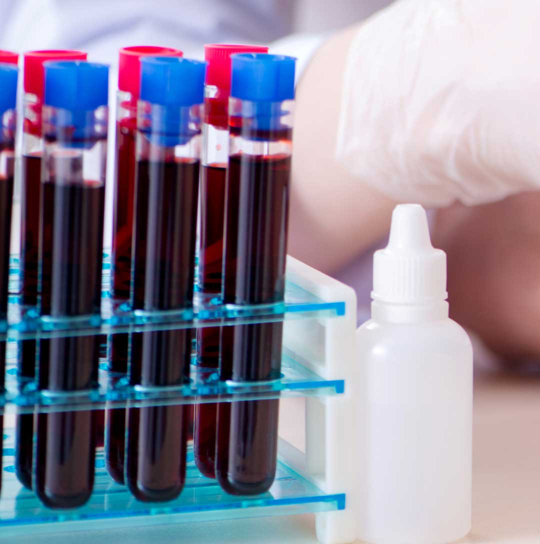 Monthly test illustration